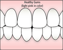 illustration of healthy gums